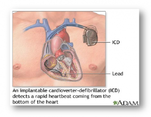 ICD, Florida Cardiology, P.A