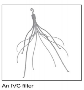 IVC Filter Replacement, Florida Cardiology, P.A