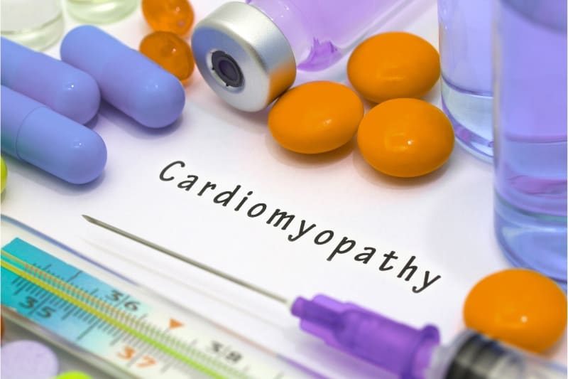 Hypertrophic Cardiomyopathy Treatment